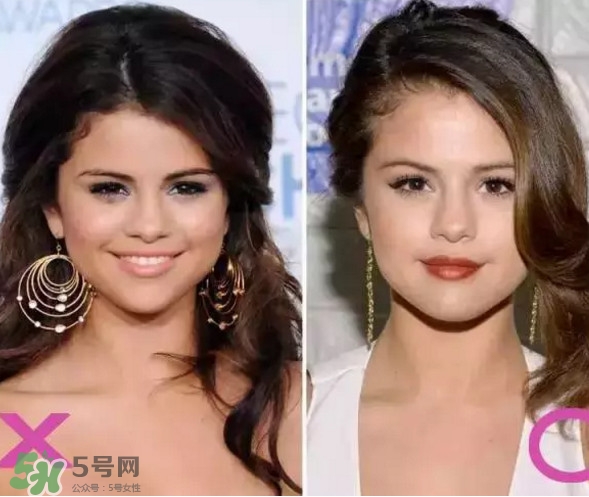 新打耳洞戴什么材質(zhì)的耳釘好？打耳洞用什么消毒最好