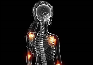 風(fēng)濕要忌口嗎？風(fēng)濕飲食禁忌