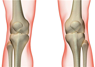 風濕不治療可以治愈嗎？早期風濕能自愈嗎？