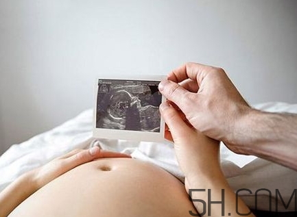 羊水過少能順產嗎？羊水過少的原因 