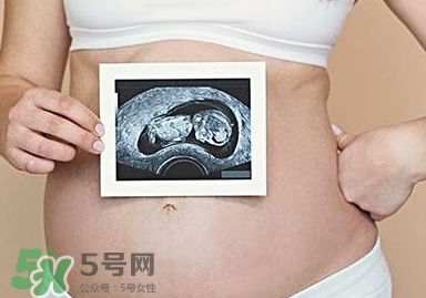 雙子宮可以上環(huán)嗎？雙子宮上環(huán)要注意哪些？