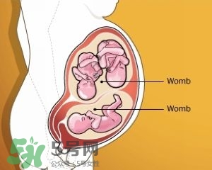 雙子宮是什么意思？雙子宮可以順產(chǎn)嗎？