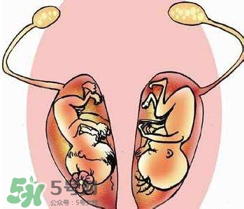 雙子宮對懷孕有影響嗎？雙子宮懷孕要注意什么？