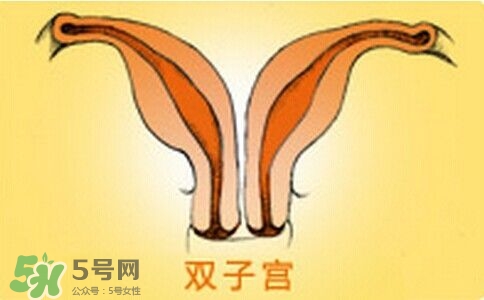 雙子宮是什么意思？雙子宮可以順產(chǎn)嗎？