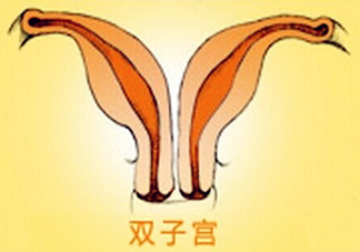 雙子宮是什么意思？雙子宮可以順產(chǎn)嗎？