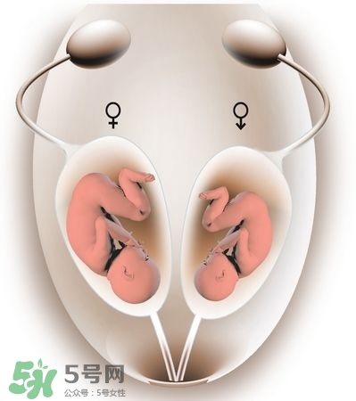 雙子宮對懷孕有影響嗎？雙子宮懷孕要注意什么？