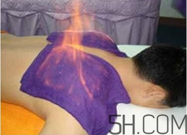 火療真的能治病嗎？火龍液的功效與作用