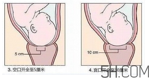 內(nèi)檢是什么感覺(jué)？?jī)?nèi)檢有男醫(yī)生嗎？