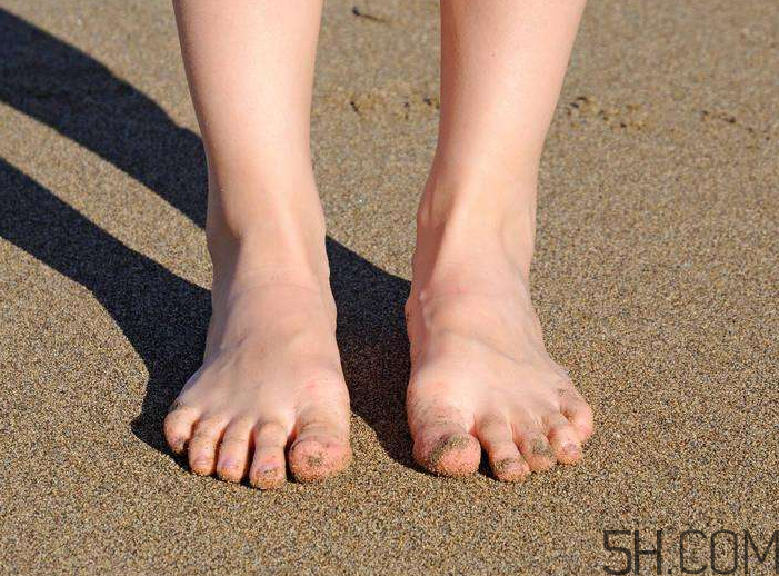 腳氣會引起灰指甲嗎？腳氣加灰指甲怎么治？