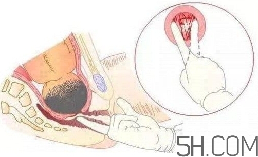 內(nèi)檢是什么感覺(jué)？?jī)?nèi)檢有男醫(yī)生嗎？