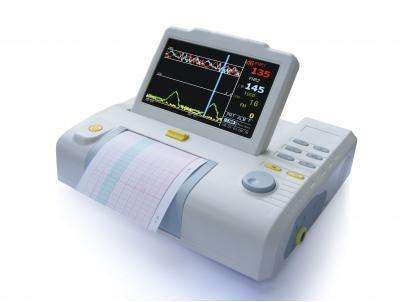 胎心監(jiān)護(hù)圖怎么看？胎心監(jiān)護(hù)多少錢？