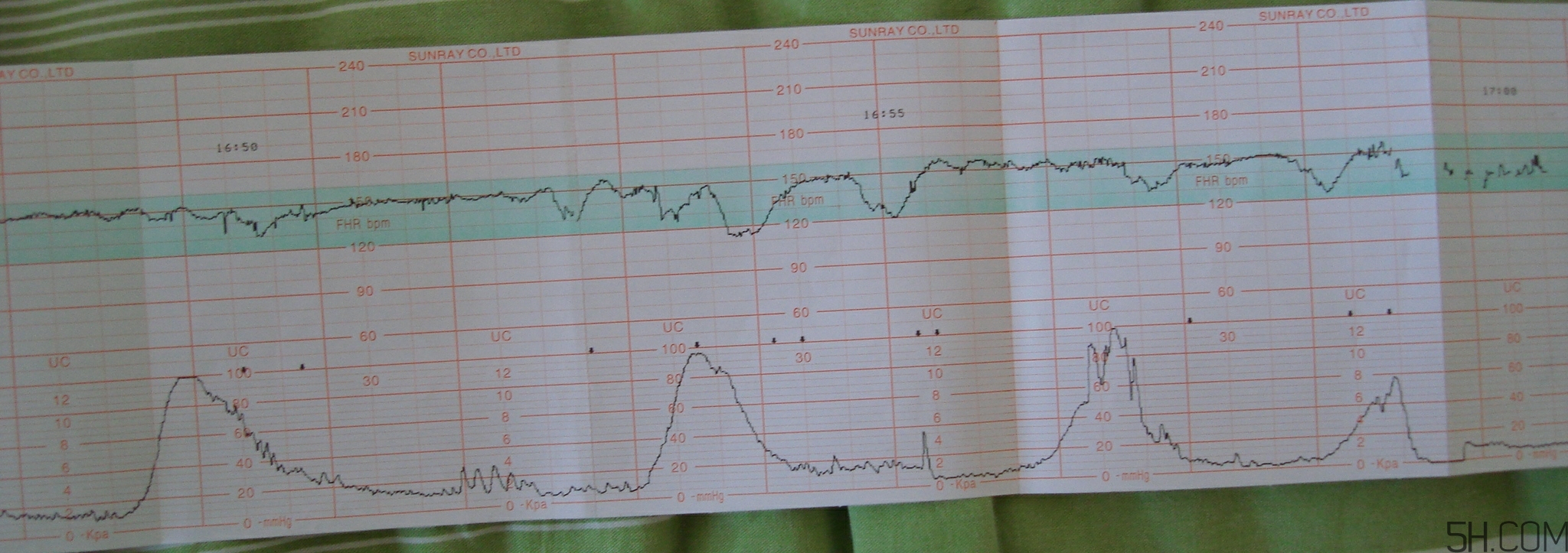 為什么要做胎心監(jiān)護？孕婦做胎心監(jiān)護有什么用？