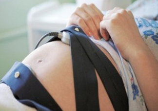 胎心監(jiān)護(hù)圖怎么看？胎心監(jiān)護(hù)多少錢？