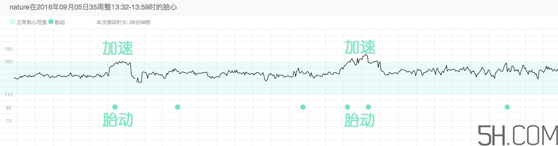 為什么要做胎心監(jiān)護？孕婦做胎心監(jiān)護有什么用？