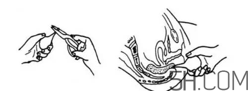 用開塞露會拉稀嗎？便秘用開塞露不管用怎么辦？