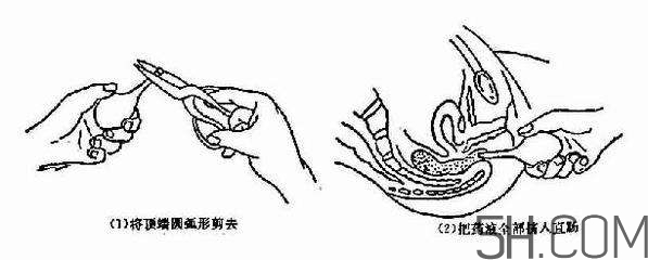 開(kāi)塞露怎么用？開(kāi)塞露用后多久會(huì)排便？