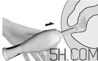 開(kāi)塞露怎么用？開(kāi)塞露用后多久會(huì)排便？