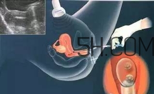 試管嬰兒有什么風(fēng)險？試管嬰兒長大后的弊端