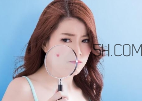 黃芪可以預(yù)防感冒嗎_黃芪適合哪些人群 黃芪可以預(yù)防感冒嗎_黃芪適合哪些人群