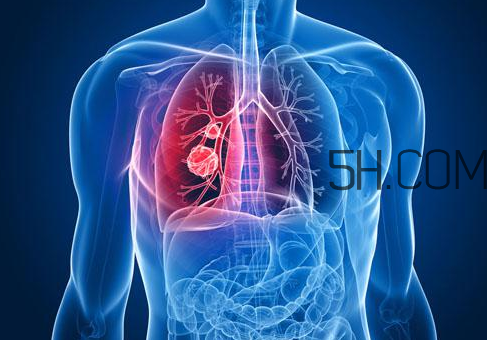 哮喘會(huì)頭暈嗎？哮喘會(huì)引起一直頭暈嗎？