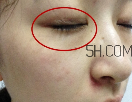 嬌韻詩(shī)眼霜孕婦可以用嗎？