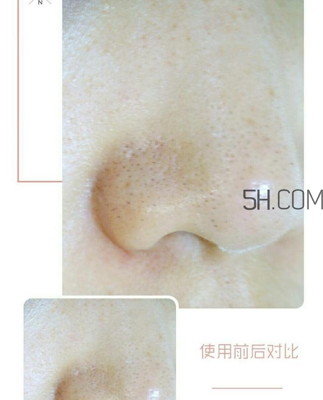 belulu美容儀怎么樣_belulu美容儀好用嗎 belulu美容儀怎么樣_belulu美容儀好用嗎