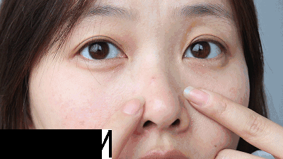 去黑頭的最好方法 5分鐘快速祛黑頭 去黑頭的最好方法 5分鐘快速祛黑頭