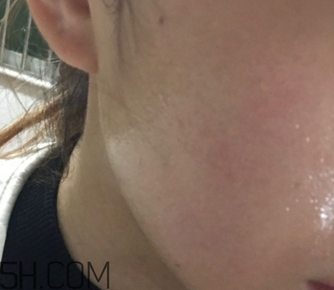 新生活國(guó)際玻尿酸補(bǔ)水面膜怎么樣？多少錢？