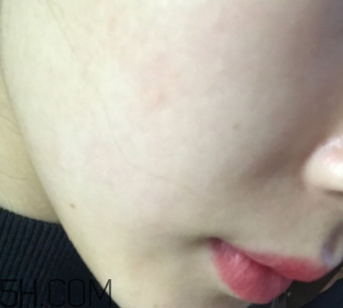 新生活國(guó)際玻尿酸補(bǔ)水面膜怎么樣？多少錢？