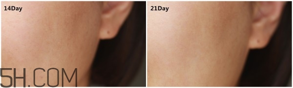 蘭蔻小黑瓶安瓶精華和雅詩蘭黛小棕瓶精華哪個好? 蘭蔻小黑瓶安瓶精華和雅詩蘭黛小棕瓶精華哪個好?