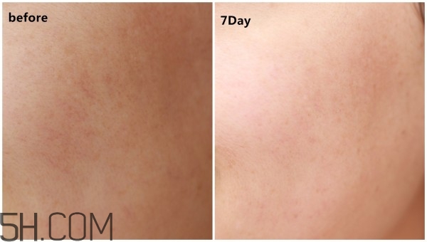 蘭蔻小黑瓶安瓶精華和雅詩蘭黛小棕瓶精華哪個好? 蘭蔻小黑瓶安瓶精華和雅詩蘭黛小棕瓶精華哪個好?