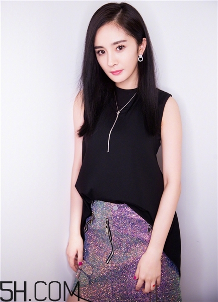 黃褐斑跟飲食有關系嗎？黃褐斑跟養(yǎng)狗有關嗎？