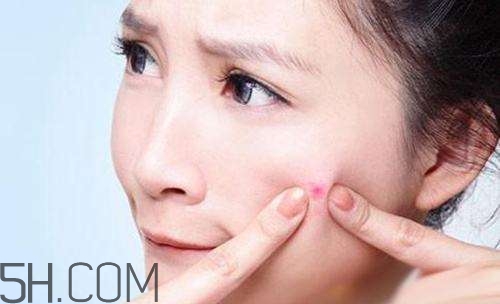 泊美祛痘系列怎么樣？泊美祛痘系列有哪些？