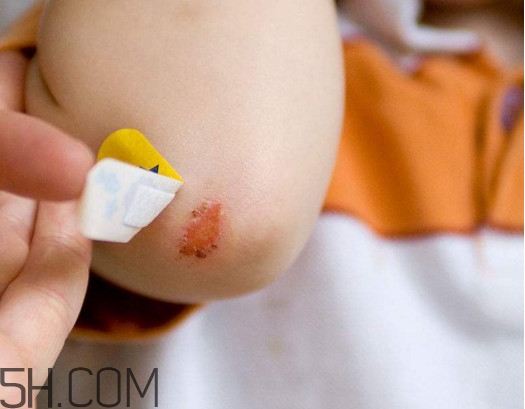 創(chuàng)可貼有消炎作用嗎？一張創(chuàng)可貼能用多長(zhǎng)時(shí)間