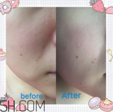 歐珀萊臻白多效角質(zhì)調(diào)理肌底液怎么樣？好用嗎？