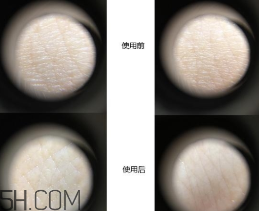 恒久肌底循環(huán)精華露基礎(chǔ)型和加強(qiáng)型區(qū)別_怎么選 恒久肌底循環(huán)精華露基礎(chǔ)型和加強(qiáng)型區(qū)別_怎么選