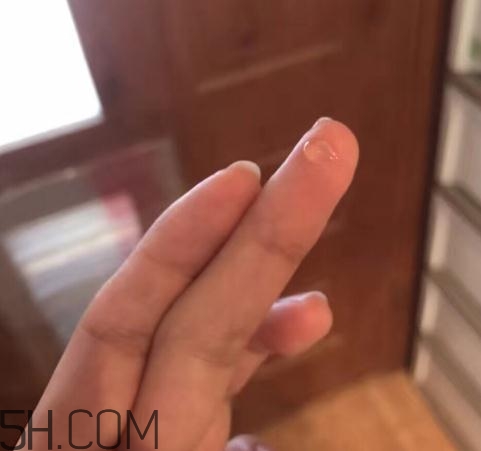 倍舒痕可以去痘印嗎？倍舒痕能涂在痘痘上嗎？