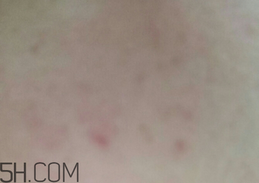 aox suaox祛痘原液怎么樣？多少錢？