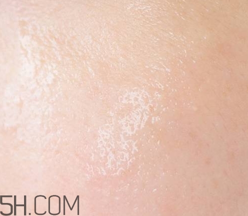 esthe dew爽膚水哪個顏色好？esthe dew化妝水不同顏色區(qū)別