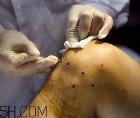 關節(jié)炎患者能喝酒嗎？喝酒對關節(jié)炎有影響嗎？