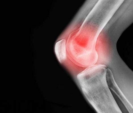 關(guān)節(jié)炎能吃螃蟹嗎？關(guān)節(jié)炎能吃海鮮嗎？