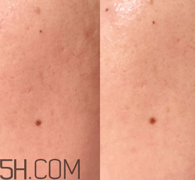 蘭蔻美容液多少錢_蘭蔻美容液功效 蘭蔻美容液多少錢_蘭蔻美容液功效