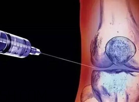 關(guān)節(jié)炎打封閉針好嗎？關(guān)節(jié)炎打封閉針有副作用嗎？