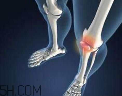 關(guān)節(jié)炎打封閉針好嗎？關(guān)節(jié)炎打封閉針有副作用嗎？