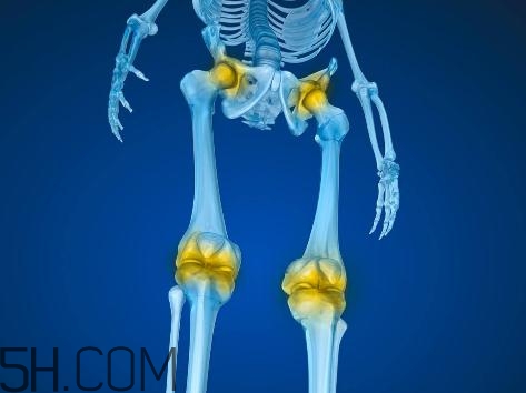 關節(jié)炎積液什么癥狀？關節(jié)炎積水怎么治療？