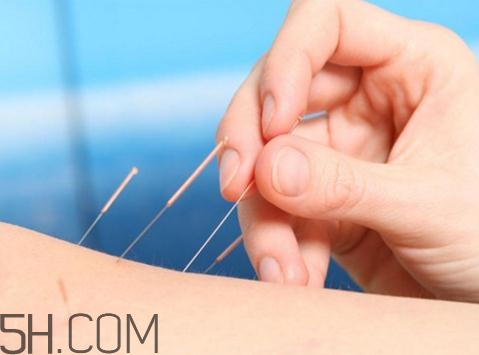 關(guān)節(jié)炎需要補(bǔ)鈣嗎？關(guān)節(jié)炎補(bǔ)鈣有用嗎？