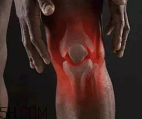 關(guān)節(jié)炎可以拔火罐嗎？關(guān)節(jié)炎拔罐管用嗎？