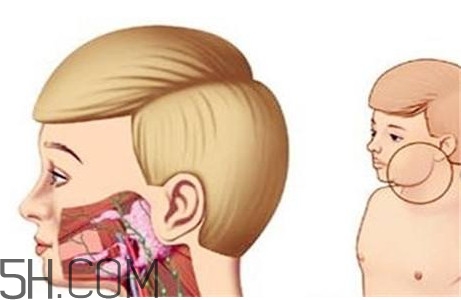 淋巴癌最嚴(yán)重時(shí)會(huì)成什么樣子？淋巴瘤能治好嗎