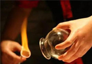 關(guān)節(jié)炎可以拔火罐嗎？關(guān)節(jié)炎拔罐管用嗎？