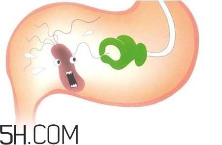 幽門螺桿菌會(huì)傳染嗎？幽門螺桿菌吃什么藥